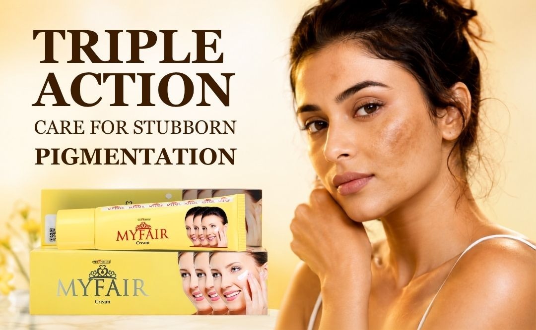 MyFair Cream: How This Triple-Action Formula Tackles Dark Spots, Melasma & Uneven Skin Tone