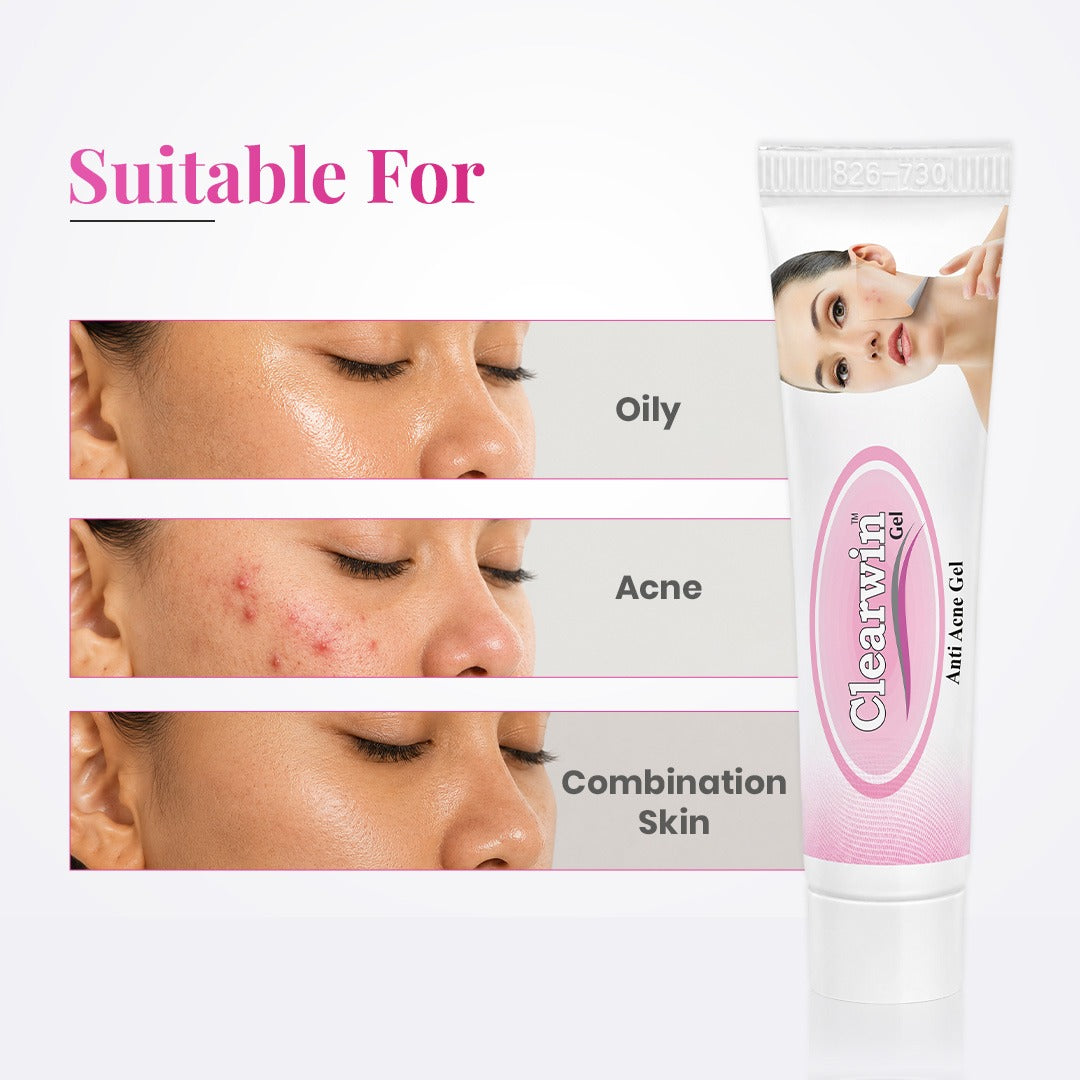 Clearwin Gel for Acne, Pimples, and Clear Skin - 15g