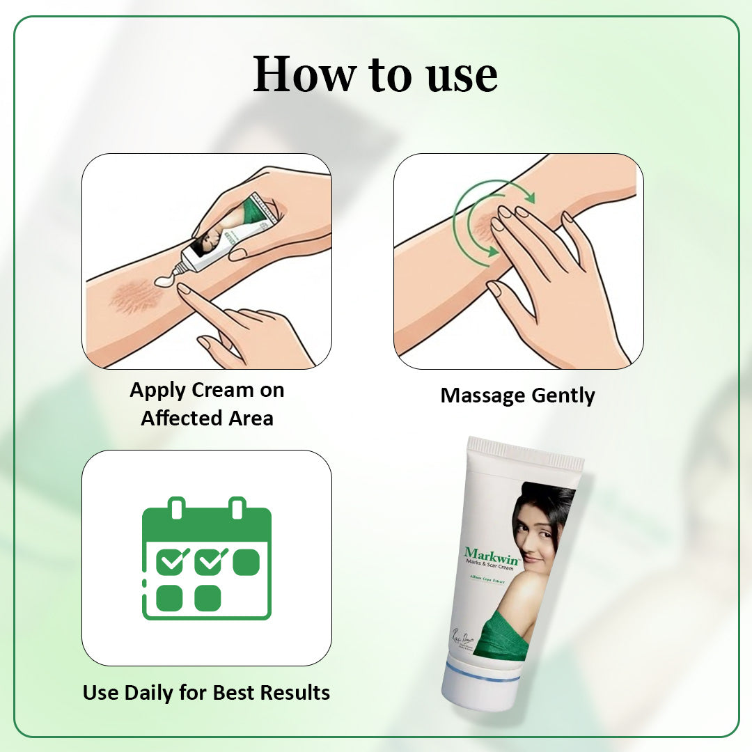 Markwin Marks & Scar Cream
