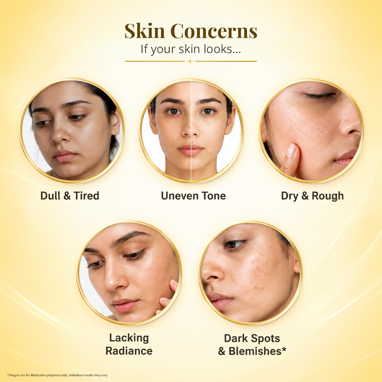 MyFair Extra Glow Cream for Skin Brightening, Radiance & Youthful Glow - 50g