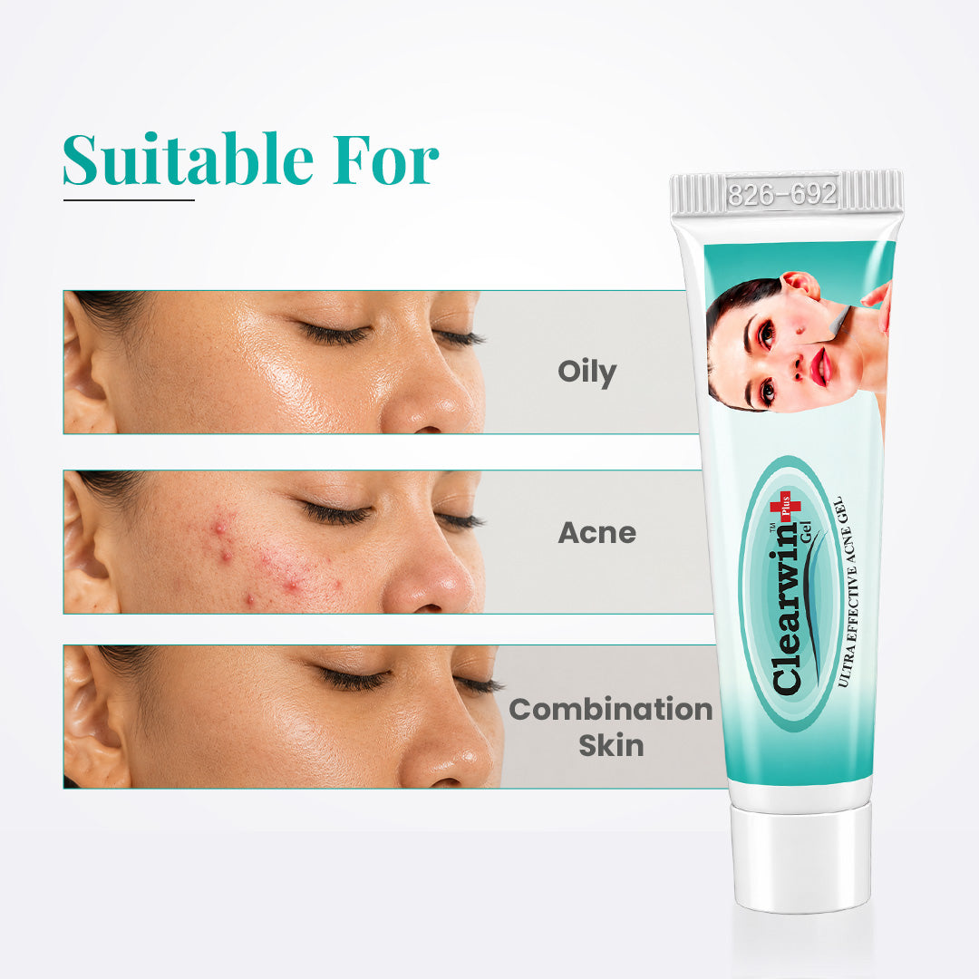 Clearwin Plus Gel for Acne, Pimples, and Clear Skin - 15g