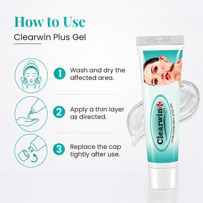 Clearwin Plus Gel for Acne, Pimples, and Clear Skin - 15g