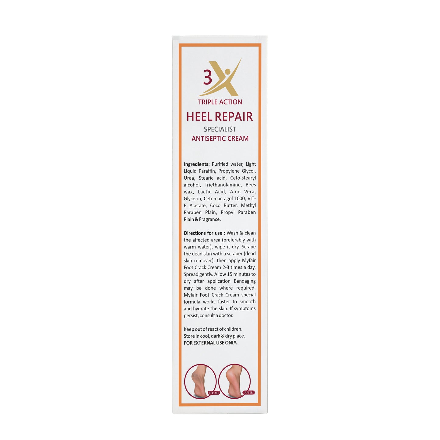 MyFair Foot Crack Cream - 60g