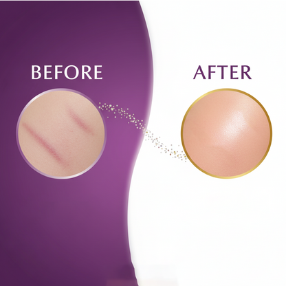 MARKWIN Pregnancy Stretch Marks & Wrinkle Cream